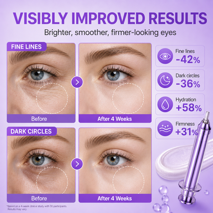NAD+ Retinol Volumizing Eye Cream – Targets Dark Circles, Puffiness, Crow’s Feet & Fine Lines with 50 Peptides, 4% Niacinamide and Ceramide, 0.33 fl oz